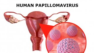 HUMAN PAPILLOMA VIRUS [upl. by Aicac940]