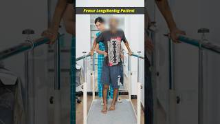 Femur Lengthening Surgery  Physiotherapy Session  Height increase Surgery [upl. by Ignacius]