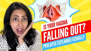 Pelvic Organ Prolapse Why It Happens with Dr Nabila Noor [upl. by Genevra]