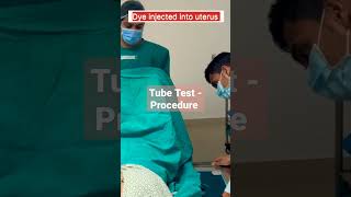 HSG Test  How its done infertility hsgtest viralshorts shorts tubetest [upl. by Burne]