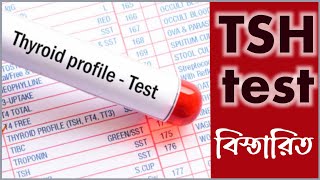 Tsh test report bangla  থাইরয়েড হরমোন টেস্ট খরচ কতো [upl. by Ardnohs280]