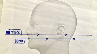 How To Take An Odontoid View XRay  Perfectly  Every Time [upl. by Atinuaj854]