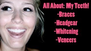 All About My Teeth Braces Headgear Whitening and Veneers [upl. by Jaclin]