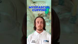 How Does Myofascial Cupping Work cuppingtherapy shorts viral chiropractic physicaltherapy [upl. by Yknip]