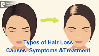 Types of Hair Loss  Common Causes Symptoms amp Treatment  Dr Kavitha GV Mandal [upl. by Ahsrop]