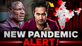 ALERT New PANDEMIC is Spreading Across The World  MPOX Virus Explained [upl. by Anilejna]