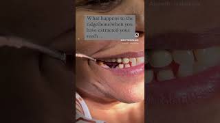 Your teeth r important dentalvideos dentalhygiene ashortaday trending dentallife youtubeshorts [upl. by Aidyn258]