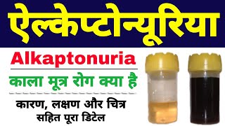 Alkaptonuria in hindi class 12 biology  black urine disease  ऐल्केप्टोन्यूरिया Biology ScienceSK [upl. by Aerahs]