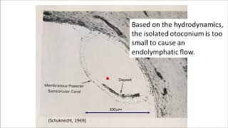 The etiology of BPPV microotoconia accumulation theory [upl. by Grayce]