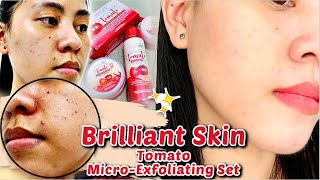 BRILLIANT SKIN TOMATO EXFOLIATINGREJUVENATING SET 5DAYS REVIEW NAGKAPIMPLES  SteffiRayVlogs🌻 [upl. by Nyrraf]