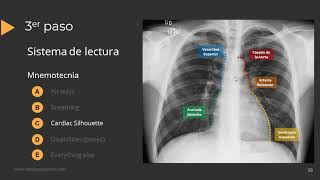 Tutorial Radiografía de Torax [upl. by Edmead472]