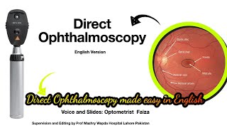 Direct Ophthalmoscopy technique made easyEnglish1 [upl. by Cnut]