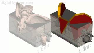 Artistic Anatomy A Simplified View of the Pelvis [upl. by Sivartal]