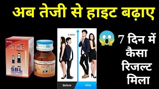 Sbl Rite Hite Tablet Honest Review in HindiRite Hite Homeopathic Tablet Resultहाइट कैसे बढ़ाए [upl. by Ramraj]