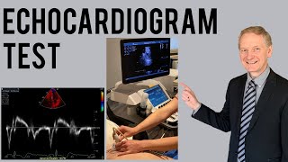 Echocardiogram Procedure  Heart Ultrasound  Everything you need to know [upl. by Veljkov330]