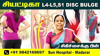 L4L5S1 DISC BULGE  FOOT NUMBNESS  Physiotherapy Treatment  RECOVERY  Sun Hospital Madurai [upl. by Horatius]