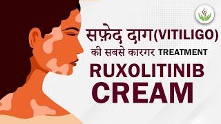 Ruxolitinib Cream  Latest Treatment For Vitiligo 2023  Care Well Medical Centre [upl. by Anairo]