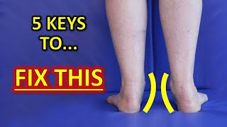 The 5 KEYS To Improve Flat Feet Fallen Arches amp Foot Overpronation [upl. by Hoehne611]