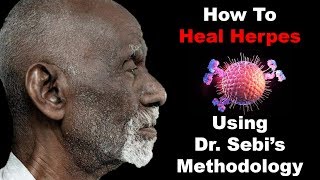 How To Heal Herpes  Using Dr Sebis Methodology [upl. by Lorusso850]