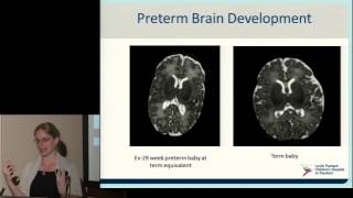 Neurodevelopment of Preterm Babies [upl. by Alaham826]