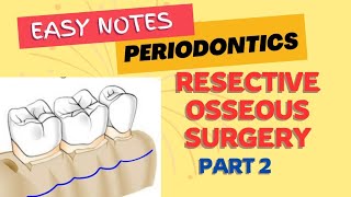 RESECTIVE OSSEOUS SURGERY  PERIODONTICS  Part 2  easy notes [upl. by Muns]