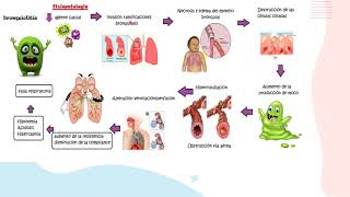 Bronquiolitis parte 1FisiopatologíaPediatría [upl. by Shanda]