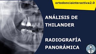 ANALÍSIS DE THILANDER EN ORTODONCIA [upl. by Wanids]