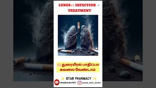 Lungs infection treatment lungs medicine hospital pharmacy [upl. by Hna441]