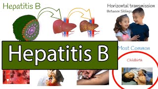 Hepatitis B symptoms treatment and prevention [upl. by Ztnaj902]