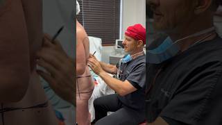 Come along for the markings process where Doc determines precise incision placement for a body lift [upl. by Cinimmod]