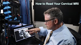 How to Read Your Cervical MRI Part I of 2 A Deep Dive Into How to Read Your Cervical MRI [upl. by Yrhcaz131]