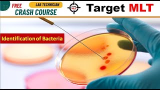 22 Biochemical Test in microbiology Identification of Bacteria molecular automatedculture 2024 [upl. by Encratia972]