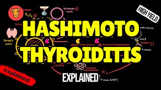 HASHIMOTO THYROIDITIS Pathogenesis Clinical Symptoms Treatment [upl. by Gray]