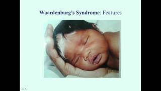 Waardenburgs Syndrome  CRASH Medical Review Series [upl. by How]