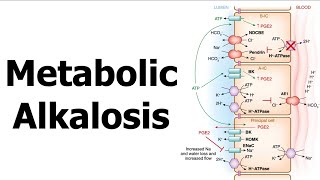 Metabolic Alkalosis [upl. by Siol467]