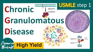 Chronic Granulomatous Disease CGD  NADPH oxidase mutation  Respiratory burst  USMLE [upl. by Fachanan]