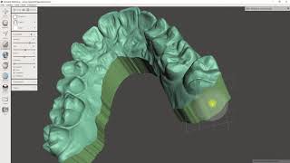 How to make a dental model in meshmixer with asiga [upl. by Kassab816]