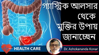 Peptic Ulcer Symptoms  কোন লক্ষণ গুলি হলে বুঝবেন গ্যাস্ট্রিক আলসার হয়েছে  Dr Ashokananda Konar [upl. by Naej542]