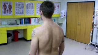 Scoliosis Test [upl. by Granville721]