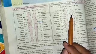 Epidemiology of neoplasia part 1 neoplasia pathology generalpathology mbbslectures [upl. by Burgess]