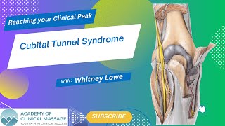 Cubital Tunnel Syndrome [upl. by Otcefrep942]