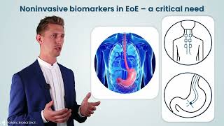 Eosinophilic Esophagitis EoE  Differentiating Patients with Bloodbased Collagen Biomarkers [upl. by Nylaf650]