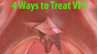 4 Ways to Treat Velopharyngeal Insufficiency VPI [upl. by Busch]