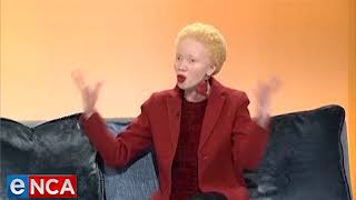 Albinism awareness month [upl. by Hump]