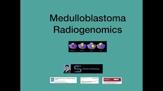 Medulloblastoma Radiogenomics Simplified [upl. by Assereht]