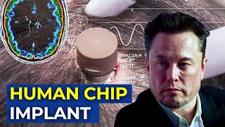 Elon Musk Neuralink implants brain chip in first human  Neuralink Human Trials [upl. by Russo]