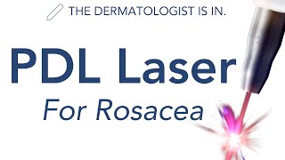 VBeam amp PDL Lasers for Rosacea  Dermatologist Explains [upl. by Eloisa]