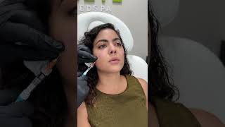 Restylane EYELIGHT  Elite Medical SPA  AntiAgeing Treatments in Boca Raton FL [upl. by Lesna398]