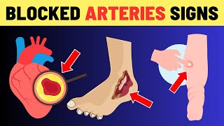 7 Warning Signs of Blocked Heart Arteries In Legs and Feet Dont Ignore These Signals  VisitJoy [upl. by Corny]