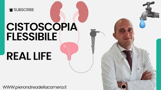 REAL LIFE CISTOSCOPIA FLESSIBILE [upl. by Mossolb]